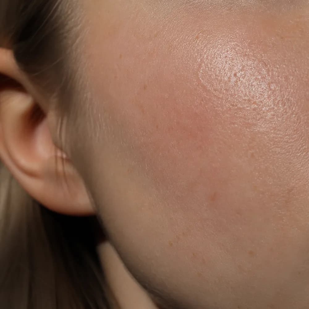 Skin Enhancer: Natural, realistic skin textures